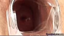 Pulled speculum beauty spreading pussy lips and butthole