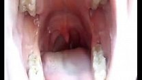 The inside of the mouth