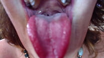 878 Linkin wants to live inside my mouth. Standing on my tongue or hanging from my uvula