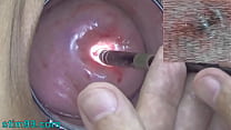 Endoscopic Camera in Cervix watch inside my Womb and Vagina. Inspection testing exam of wife by extreme doctor gynecologist