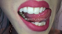 Trice Mouth Video 1