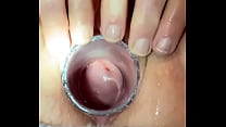 Pussy spread painfully exposing cervix