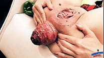 Insanely Huge Prolapse! Cervix Exposure. Eggplant Penetratio