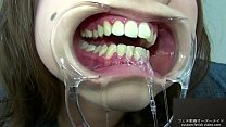 Teeth fetish
