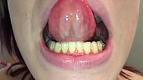 Kristy Mouth Part3 Video 1